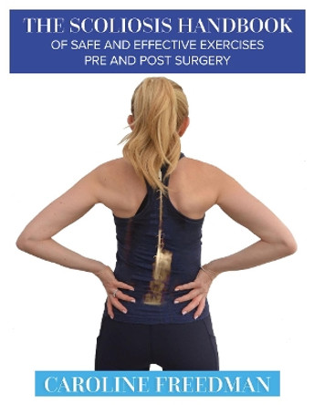 The Scoliosis Handbook of Safe and Effective Exercises Pre and Post Surgery by Caroline Freedman 9781781611661