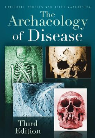 The Archaeology of Disease: Third Edition by Charlotte Roberts 9780752457505