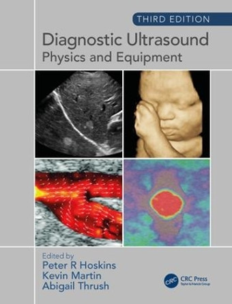 Diagnostic Ultrasound, Third Edition: Physics and Equipment by Peter R Hoskins 9781138892934