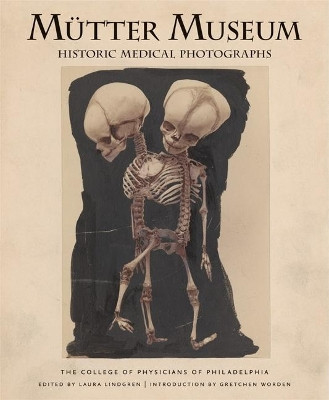 Mutter Museum Historic Medical Photographs by Laura Lindgren 9780922233281