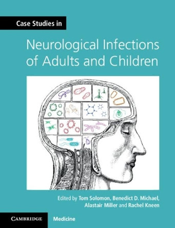 Case Studies in Neurological Infections of Adults and Children by Tom Solomon 9781107634916