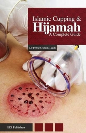 Islamic Cupping & Hijamah: A Complete Guide by Mufti Afzal Hoosen Elias 9780991145508