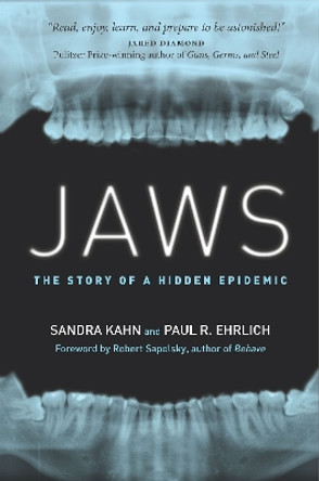 Jaws: The Story of a Hidden Epidemic by Paul Ehrlich 9781503604131