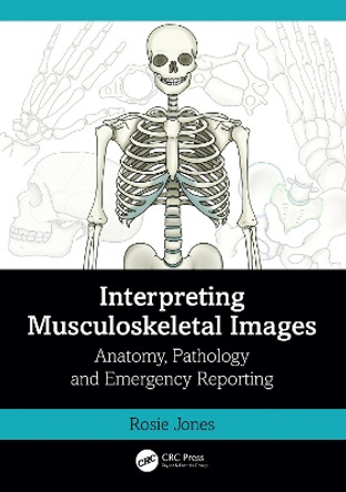 Interpreting Musculoskeletal Images: Anatomy, Pathology and Emergency Reporting by Rosie Jones 9781032398914