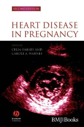 Heart Disease in Pregnancy by Celia Oakley 9781405134880