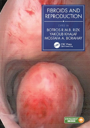 Fibroids and Reproduction by Botros R.M.B. Rizk 9780367550677