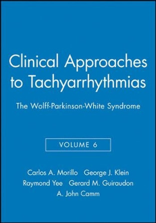 The Wolff–Parkinson–White Syndrome by C Morillo 9780879936600