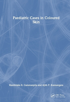 Paediatric Cases in Coloured Skin by Ranthilaka R. Gammanpila 9781032343167