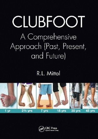 Clubfoot: A Comprehensive Approach (Past, Present, and Future) by R. L. Mittal 9780367656010