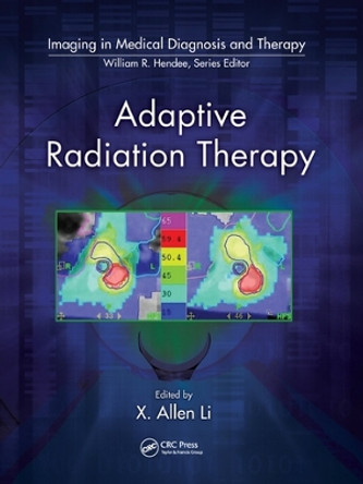 Adaptive Radiation Therapy by X. Allen Li 9780367577001