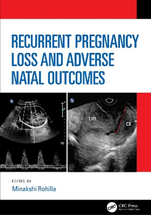 Recurrent Pregnancy Loss and Adverse Natal Outcomes by Minakshi Rohilla 9781138351820