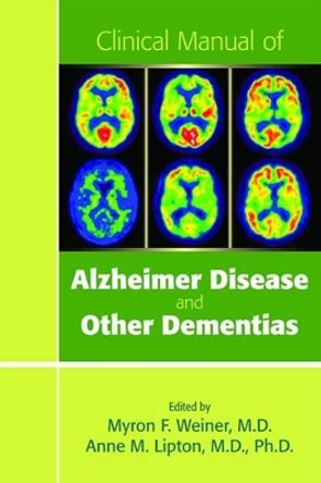 Clinical Manual of Alzheimer Disease and Other Dementias by Myron F. Weiner 9781585624225