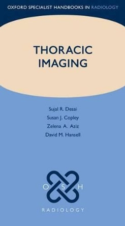Thoracic Imaging by Sujal R. Desai 9780199560479
