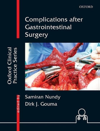 Complications after Gastrointestinal Surgery by Samiran Nundy 9780199475186