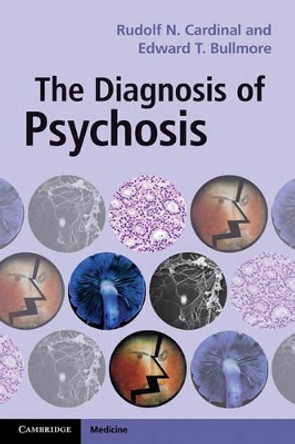 The Diagnosis of Psychosis by Rudolf N. Cardinal 9780521164849