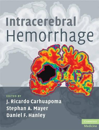 Intracerebral Hemorrhage by J. Ricardo Carhuapoma 9780521873314