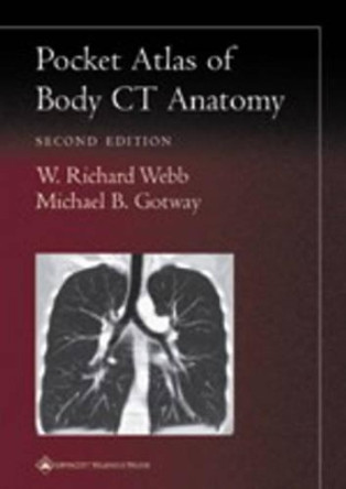 Pocket Atlas of Body CT Anatomy by W.Richard Webb 9780781736633