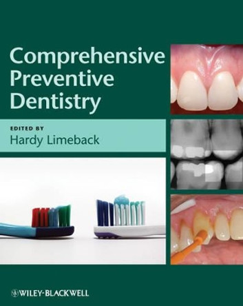 Comprehensive Preventive Dentistry by Hardy Limeback 9780813821689