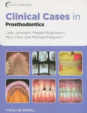 Clinical Cases in Prosthodontics by Leila Jahangiri 9780813816647