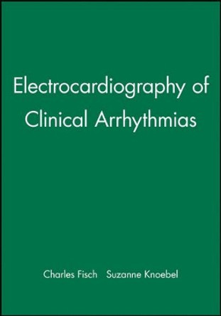 Electrocardiography of Clinical Arrhythmias by Charles Fisch 9780879934460