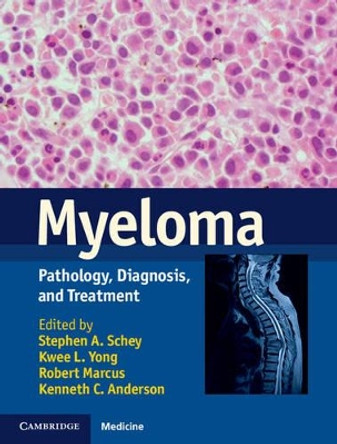 Myeloma: Pathology, Diagnosis, and Treatment by Stephen A. Schey 9781107010574