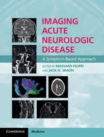 Imaging Acute Neurologic Disease: A Symptom-Based Approach by Massimo Filippi 9781107035942