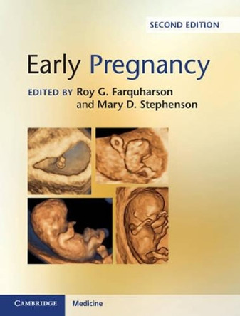 Early Pregnancy by Roy G. Farquharson 9781107082014