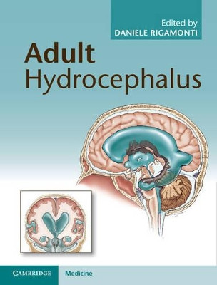 Adult Hydrocephalus by Daniele Rigamonti 9781107031777