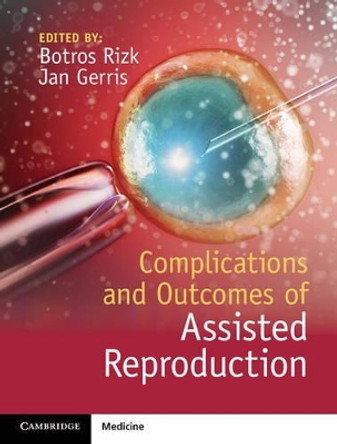 Complications and Outcomes of Assisted Reproduction by Botros Rizk 9781107055643