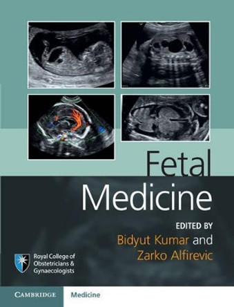 Fetal Medicine by Bidyut Kumar 9781107064348