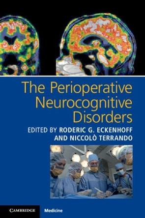 The Perioperative Neurocognitive Disorders by Roderic G. Eckenhoff 9781107559202