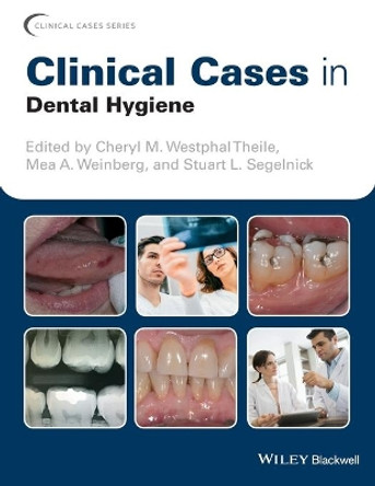 Clinical Cases in Dental Hygiene by Cheryl M. Westphal Theile 9781119145028