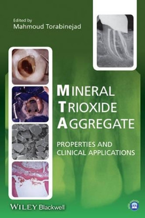Mineral Trioxide Aggregate: Properties and Clinical Applications by Mahmoud Torabinejad 9781118401286