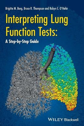 Interpreting Lung Function Tests: A Step-by Step Guide by Bruce R. Thompson 9781118405512