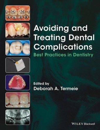 Avoiding and Treating Dental Complications: Best Practices in Dentistry by Deborah Termeie 9781118988022