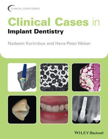 Clinical Cases in Implant Dentistry by Nadeem Karimbux 9781118702147