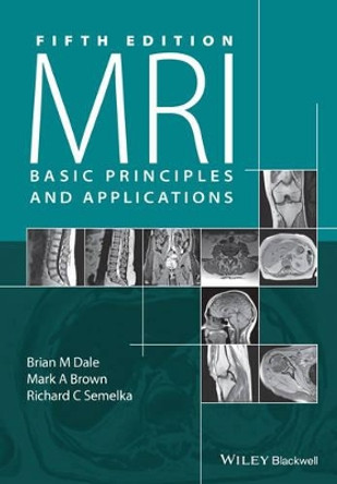 Mri: Basic Principles and Applications by Brian M. Dale 9781119013051