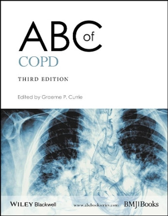 ABC of COPD by Graeme P. Currie 9781119212850