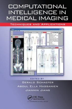 Computational Intelligence in Medical Imaging: Techniques and Applications by G. Schaefer 9781138112209