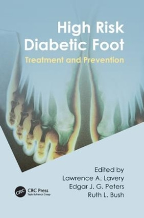 High Risk Diabetic Foot: Treatment and Prevention by Lawrence A. Lavery 9781138114159
