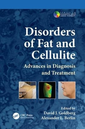Disorders of Fat and Cellulite: Advances in Diagnosis and Treatment by David J. Goldberg 9781138114661