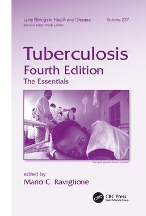 Tuberculosis: The Essentials, Fourth Edition by Mario C. Raviglione 9781138117662