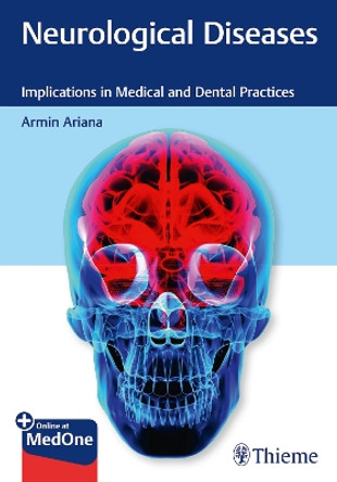 Neurological Diseases: Implications in Medical and Dental Practices by Armin Ariana 9781684202249