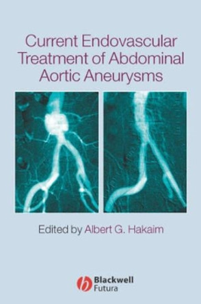 Current Endovascular Treatment of Abdominal Aortic Aneurysms by Albert Hakaim 9781405122054