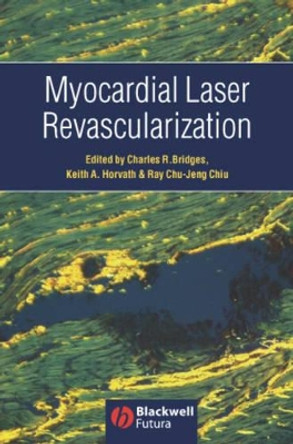 Myocardial Laser Revascularization by Charles Bridges 9781405122108