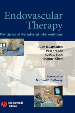 Endovascular Therapy: Principles of Peripheral Interventions by Alan B. Lumsden 9781405124232