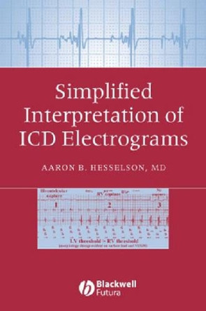 Simplified Interpretation of ICD Electrograms Aaron B. Hesselson (Wayne State University School of Medicine) 9781405127318