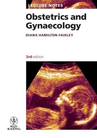 Lecture Notes: Obstetrics and Gynaecology by Diana Hamilton-Fairley 9781405178013