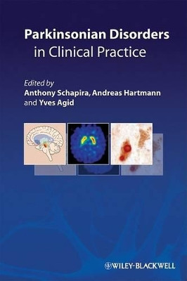 Parkinsonian Disorders in Clinical Practice Anthony Schapira 9781405196017