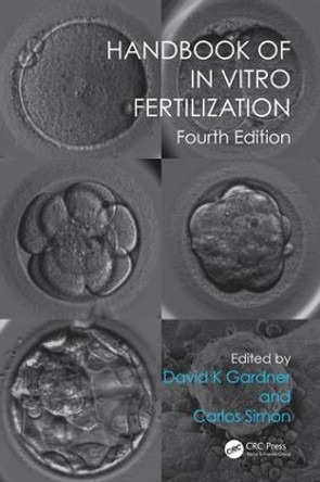 Handbook of In Vitro Fertilization by David K. Gardner 9781498729390